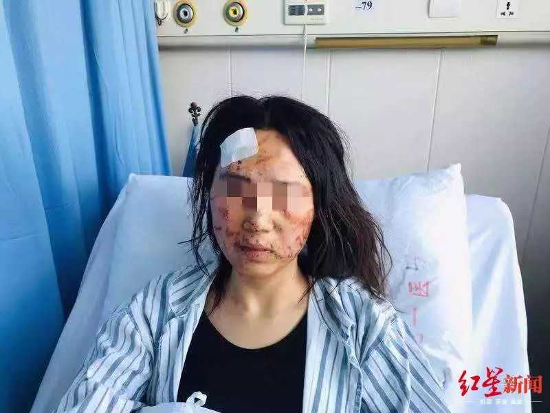 女子被打后遭推进面包车?警方回应女子被打后遭推进面包车事件曝光，警方迅速回应